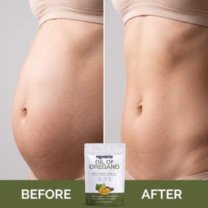 Nevaria® Oil Of Oregano Softgels